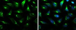 Invitrogen B4GALT1 Polyclonal Antibody 100 μL; Unconjugated:Antibodies,