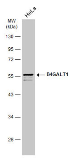 Invitrogen B4GALT1 Polyclonal Antibody 100 μL; Unconjugated:Antibodies,