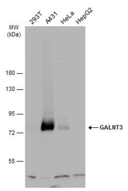 Invitrogen GALNT3 Polyclonal Antibody 100 &mu;L | Buy Online | Invitrogen&trade; | Fisher Scientific
