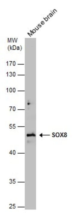 Invitrogen SOX8 Polyclonal Antibody 100 &mu;L; Unconjugated:Antibodies,