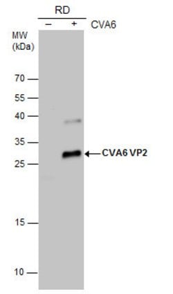 Invitrogen Coxsackievirus A6 VP2 Polyclonal Antibody 100 &mu;L; Unconjugated:Antibodies,