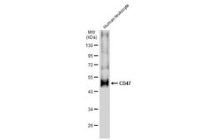 Invitrogen CD47 Polyclonal Antibody 100 &mu;L; Unconjugated:Antibodies,