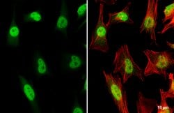 Invitrogen TRF2 Polyclonal Antibody 100 &mu;L; Unconjugated:Antibodies,