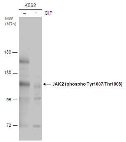 Invitrogen Phospho-JAK2 (Tyr1007, Tyr1008) Polyclonal Antibody 100 &mu;L | Buy Online | Invitrogen&trade; | Fisher Scientific
