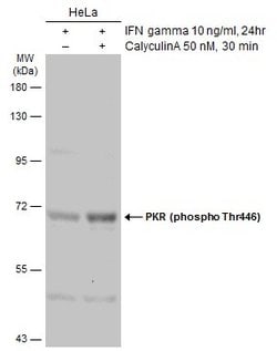 Invitrogen Phospho-PKR (Thr446) Polyclonal Antibody 100 &mu;L; Unconjugated:Antibodies,
