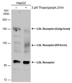 Invitrogen LDL receptor Polyclonal Antibody 100 &mu;L; Unconjugated:Antibodies,