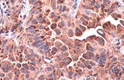 Invitrogen CD63 Polyclonal Antibody 100 &mu;L; Unconjugated:Antibodies,