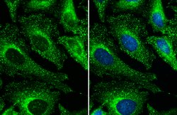 Invitrogen Clathrin Heavy Chain Polyclonal Antibody 100 &mu;L; Unconjugated:Antibodies,