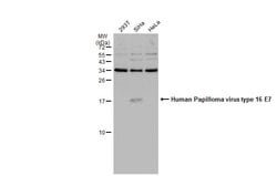 Invitrogen&trade;&nbsp;HPV Type 16 E7 Polyclonal Antibody