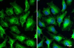 Invitrogen&trade;&nbsp;HPV Type 18 E7 Polyclonal Antibody