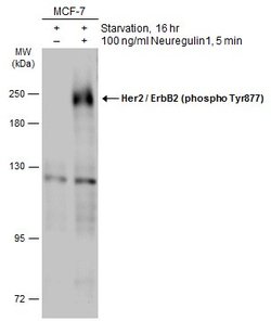 Invitrogen Phospho-ERBB2 (Tyr877) Polyclonal Antibody 100 &mu;L; Unconjugated:Antibodies,