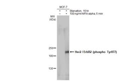 Invitrogen Phospho-ERBB2 (Tyr877) Polyclonal Antibody 100 &mu;L; Unconjugated:Antibodies,