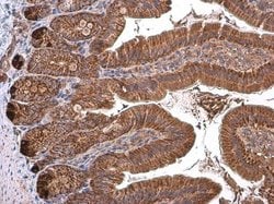 Invitrogen TOMM40 Polyclonal Antibody 100 μL; Unconjugated:Antibodies,
