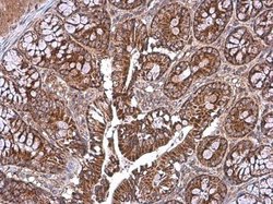 Invitrogen TOMM40 Polyclonal Antibody 100 μL; Unconjugated:Antibodies,