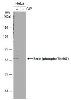 Invitrogen Phospho-Ezrin (Thr567) Polyclonal Antibody 100 &mu;L | Buy Online | Invitrogen&trade; | Fisher Scientific