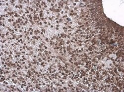 Invitrogen Neurogenin 1 Polyclonal Antibody 100 &mu;L; Unconjugated:Antibodies,