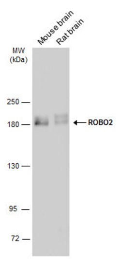 Invitrogen Robo2 Polyclonal Antibody 100 &mu;L; Unconjugated:Antibodies,