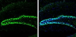 Invitrogen HuC Polyclonal Antibody 100 &mu;L; Unconjugated:Antibodies,