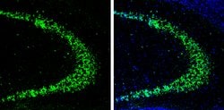 Invitrogen HuC Polyclonal Antibody 100 &mu;L; Unconjugated:Antibodies,