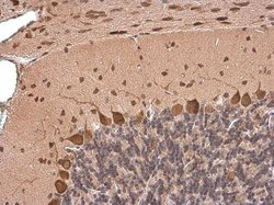 Invitrogen HuC Polyclonal Antibody 100 &mu;L; Unconjugated:Antibodies,