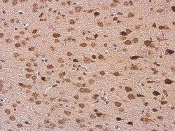 Invitrogen HuC Polyclonal Antibody 100 &mu;L; Unconjugated:Antibodies,