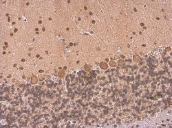Invitrogen HuC Polyclonal Antibody 100 &mu;L; Unconjugated:Antibodies,