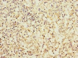 Invitrogen CD1c Polyclonal Antibody 100 &mu;L; Unconjugated:Antibodies,