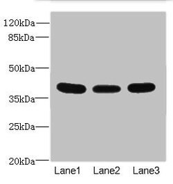 Invitrogen CD1c Polyclonal Antibody 100 &mu;L; Unconjugated:Antibodies,