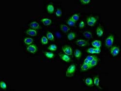 Invitrogen CD1c Polyclonal Antibody 100 &mu;g; Unconjugated:Antibodies,
