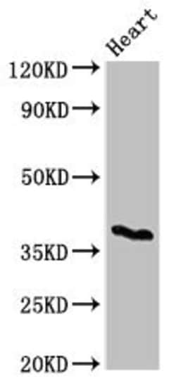 Invitrogen CD1c Polyclonal Antibody 100 &mu;g; Unconjugated:Antibodies,