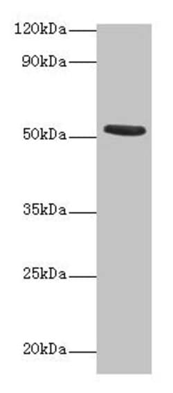 Invitrogen Torpedo californica CHRNA1 Polyclonal Antibody 100 &mu;g; Unconjugated:Antibodies,