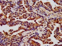 Invitrogen CHRNB3 Polyclonal Antibody 100 &mu;g; Unconjugated:Antibodies,