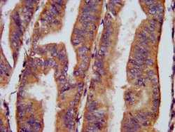 Invitrogen CHRNB3 Polyclonal Antibody 100 &mu;g; Unconjugated:Antibodies,