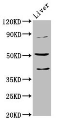 Invitrogen CHRNB3 Polyclonal Antibody 100 &mu;g; Unconjugated:Antibodies,