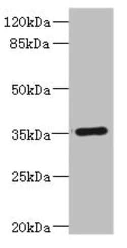 Invitrogen CD32c (FCGR2C) Polyclonal Antibody 100 &mu;L; Unconjugated:Antibodies,