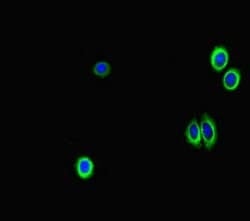 Invitrogen GAA Polyclonal Antibody 100 μg; Unconjugated:Antibodies,