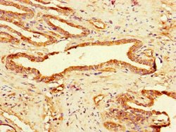 Invitrogen GAA Polyclonal Antibody 100 μg; Unconjugated:Antibodies,