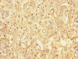 Invitrogen GAA Polyclonal Antibody 100 μg; Unconjugated:Antibodies,
