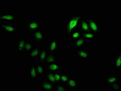 Invitrogen Crotonyl-HIST1H2BC (Lys20) Polyclonal Antibody 100 &mu;L; Unconjugated:Antibodies,