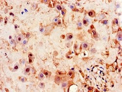 Invitrogen PITX3 Polyclonal Antibody 100 &mu;g; Unconjugated:Antibodies,