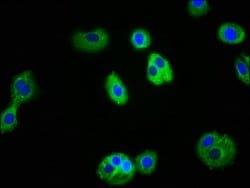 Invitrogen IL1R1 Polyclonal Antibody 100 &mu;g; Unconjugated:Antibodies,