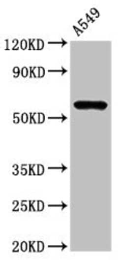 Invitrogen IL1R1 Polyclonal Antibody 100 &mu;g; Unconjugated:Antibodies,