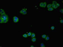 Invitrogen CD25 Polyclonal Antibody 100 &mu;g | Buy Online | Invitrogen&trade; | Fisher Scientific