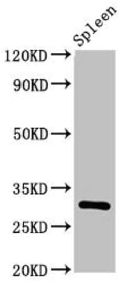 Invitrogen CD25 Polyclonal Antibody 100 &mu;g | Buy Online | Invitrogen&trade; | Fisher Scientific