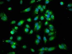 Invitrogen ARHGEF7 Polyclonal Antibody 100 &mu;g; Unconjugated:Antibodies,
