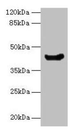 Invitrogen E. coli manA Polyclonal Antibody 100 &mu;g; Unconjugated:Antikörper