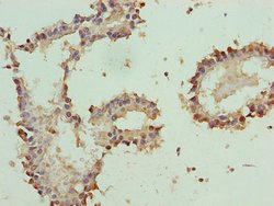 Invitrogen PLP1 Polyclonal Antibody 100 &mu;g | Buy Online | Invitrogen&trade; | Fisher Scientific