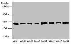 Invitrogen PLP1 Polyclonal Antibody 100 &mu;g | Buy Online | Invitrogen&trade; | Fisher Scientific