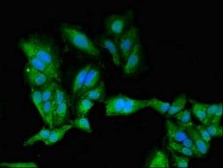 Invitrogen PKA beta Polyclonal Antibody 100 μg; Unconjugated:Antibodies,