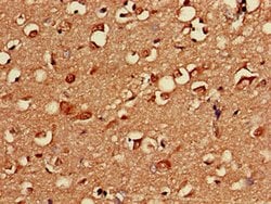Invitrogen PKA beta Polyclonal Antibody 100 μg; Unconjugated:Antibodies,